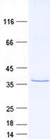 TAMM41 / C3orf31 Protein