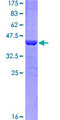 TANK Protein - 12.5% SDS-PAGE of human TANK stained with Coomassie Blue