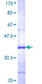 TANK2 / TNKS2 Protein - 12.5% SDS-PAGE Stained with Coomassie Blue.