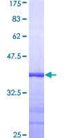 TAOK2 / TAO2 Protein - 12.5% SDS-PAGE Stained with Coomassie Blue.