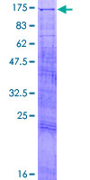 TAOK3 / JIK Protein - 12.5% SDS-PAGE of human TAOK3 stained with Coomassie Blue