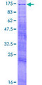 TAOK3 / JIK Protein - 12.5% SDS-PAGE of human TAOK3 stained with Coomassie Blue