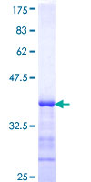 TAOK3 / JIK Protein - 12.5% SDS-PAGE Stained with Coomassie Blue.