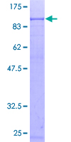 TAP2 Protein - 12.5% SDS-PAGE of human TAP2 stained with Coomassie Blue
