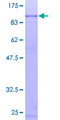 TAP2 Protein - 12.5% SDS-PAGE of human TAP2 stained with Coomassie Blue