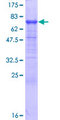 TAPBPL / TAPBPR Protein - 12.5% SDS-PAGE of human TAPBPL stained with Coomassie Blue