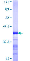 TAPBPL / TAPBPR Protein - 12.5% SDS-PAGE Stained with Coomassie Blue.