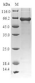 TARBP2 / TRBP2 Protein - (Tris-Glycine gel) Discontinuous SDS-PAGE (reduced) with 5% enrichment gel and 15% separation gel.