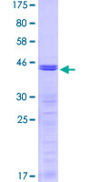 TARBP2 / TRBP2 Protein - 12.5% SDS-PAGE Stained with Coomassie Blue.