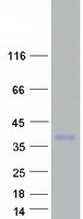 TARM1 Protein - Purified recombinant protein TARM1 was analyzed by SDS-PAGE gel and Coomassie Blue Staining