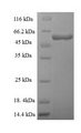 TARS2 / TARSL1 Protein - (Tris-Glycine gel) Discontinuous SDS-PAGE (reduced) with 5% enrichment gel and 15% separation gel.