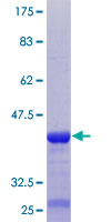 TARSH / ABI3BP Protein - 12.5% SDS-PAGE Stained with Coomassie Blue.