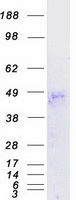 TAS2R38 Protein - Purified recombinant protein TAS2R38 was analyzed by SDS-PAGE gel and Coomassie Blue Staining