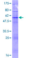 TAS2R43 Protein - 12.5% SDS-PAGE of human TAS2R43 stained with Coomassie Blue