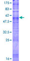 TAS2R7 / T2R7 Protein - 12.5% SDS-PAGE of human TAS2R7 stained with Coomassie Blue