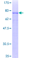 TASP1 Protein - 12.5% SDS-PAGE of human TASP1 stained with Coomassie Blue