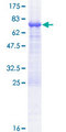 TASP1 Protein - 12.5% SDS-PAGE of human TASP1 stained with Coomassie Blue