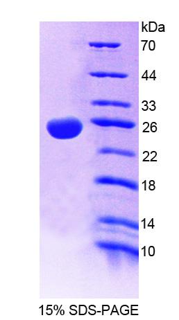 TASP1 Protein - Recombinant Threonine Aspartase 1 By SDS-PAGE