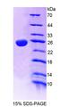TASP1 Protein - Recombinant Threonine Aspartase 1 By SDS-PAGE