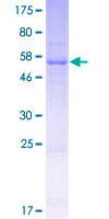 TATDN1 Protein - 12.5% SDS-PAGE of human TATDN1 stained with Coomassie Blue