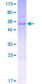 TATDN1 Protein - 12.5% SDS-PAGE of human TATDN1 stained with Coomassie Blue