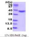 TATDN1 Protein