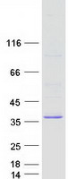 TATDN3 Protein - Purified recombinant protein TATDN3 was analyzed by SDS-PAGE gel and Coomassie Blue Staining