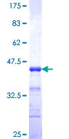 TAX1BP1 Protein - 12.5% SDS-PAGE Stained with Coomassie Blue.