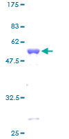 TAZ Protein - 12.5% SDS-PAGE of human TAZ stained with Coomassie Blue