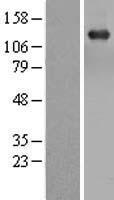TBC1 / TBC1D1 Protein - Western validation with an anti-DDK antibody * L: Control HEK293 lysate R: Over-expression lysate