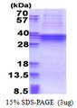 TBC1 / TBC1D1 Protein