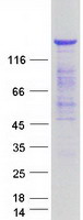TBC1 / TBC1D1 Protein - Purified recombinant protein TBC1D1 was analyzed by SDS-PAGE gel and Coomassie Blue Staining