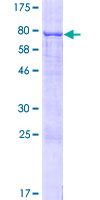 TBC1D10C / CARABIN Protein - 12.5% SDS-PAGE of human TBC1D10C stained with Coomassie Blue