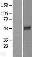 TBC1D13 Protein - Western validation with an anti-DDK antibody * L: Control HEK293 lysate R: Over-expression lysate
