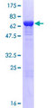 TBC1D13 Protein - 12.5% SDS-PAGE of human TBC1D13 stained with Coomassie Blue
