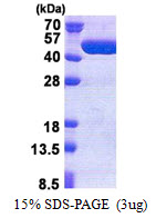TBC1D13 Protein