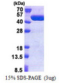 TBC1D13 Protein