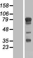 TBC1D14 Protein - Western validation with an anti-DDK antibody * L: Control HEK293 lysate R: Over-expression lysate