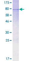 TBC1D19 Protein - 12.5% SDS-PAGE of human TBC1D19 stained with Coomassie Blue