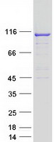 TBC1D2 Protein - Purified recombinant protein TBC1D2 was analyzed by SDS-PAGE gel and Coomassie Blue Staining