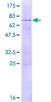 TBC1D20 Protein - 12.5% SDS-PAGE of human TBC1D20 stained with Coomassie Blue
