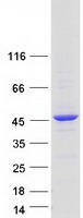 TBC1D20 Protein - Purified recombinant protein TBC1D20 was analyzed by SDS-PAGE gel and Coomassie Blue Staining
