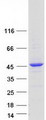 TBC1D20 Protein - Purified recombinant protein TBC1D20 was analyzed by SDS-PAGE gel and Coomassie Blue Staining