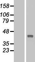 TBC1D21 Protein - Western validation with an anti-DDK antibody * L: Control HEK293 lysate R: Over-expression lysate