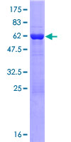 TBC1D21 Protein - 12.5% SDS-PAGE of human TBC1D21 stained with Coomassie Blue