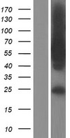 TBC1D22A Protein - Western validation with an anti-DDK antibody * L: Control HEK293 lysate R: Over-expression lysate