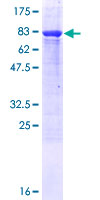 TBC1D22B Protein - 12.5% SDS-PAGE of human TBC1D22B stained with Coomassie Blue