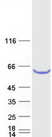 TBC1D24 Protein - Purified recombinant protein TBC1D24 was analyzed by SDS-PAGE gel and Coomassie Blue Staining