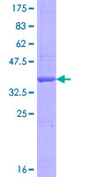 TBC1D25 Protein - 12.5% SDS-PAGE Stained with Coomassie Blue.