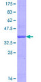 TBC1D25 Protein - 12.5% SDS-PAGE Stained with Coomassie Blue.